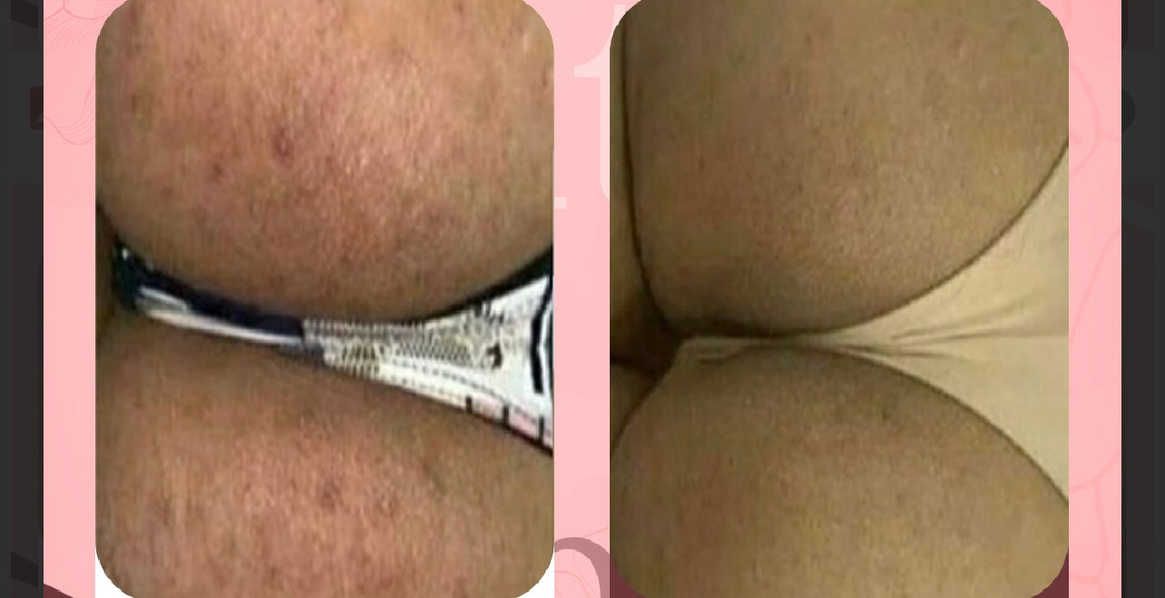 SwenPo Intimate Brightening Kit