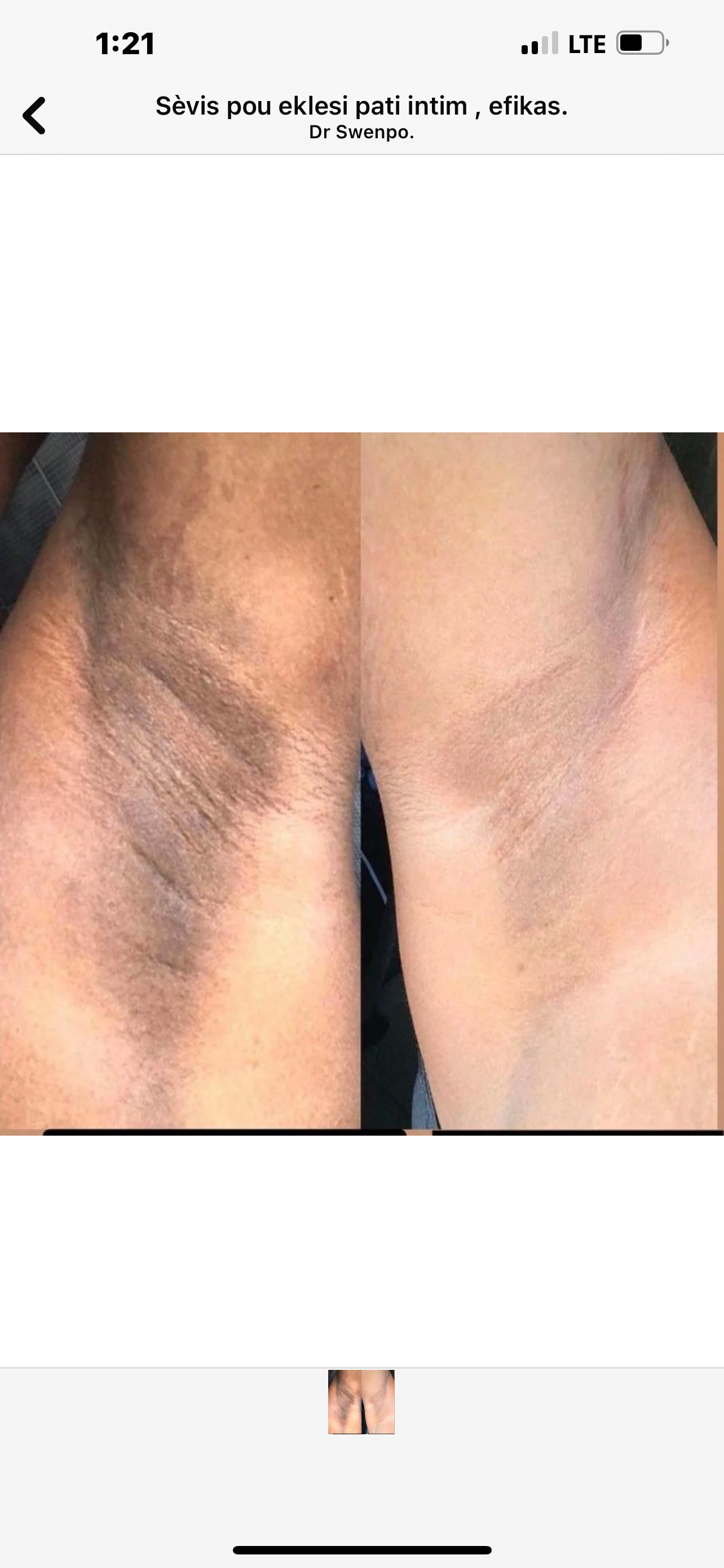 SwenPo Intimate Brightening Kit