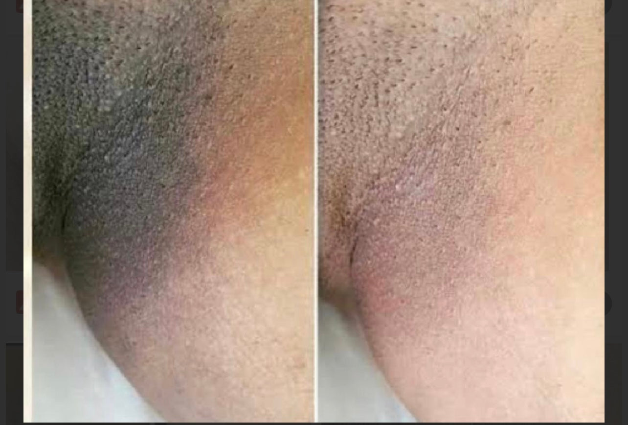 SwenPo Intimate Brightening Kit